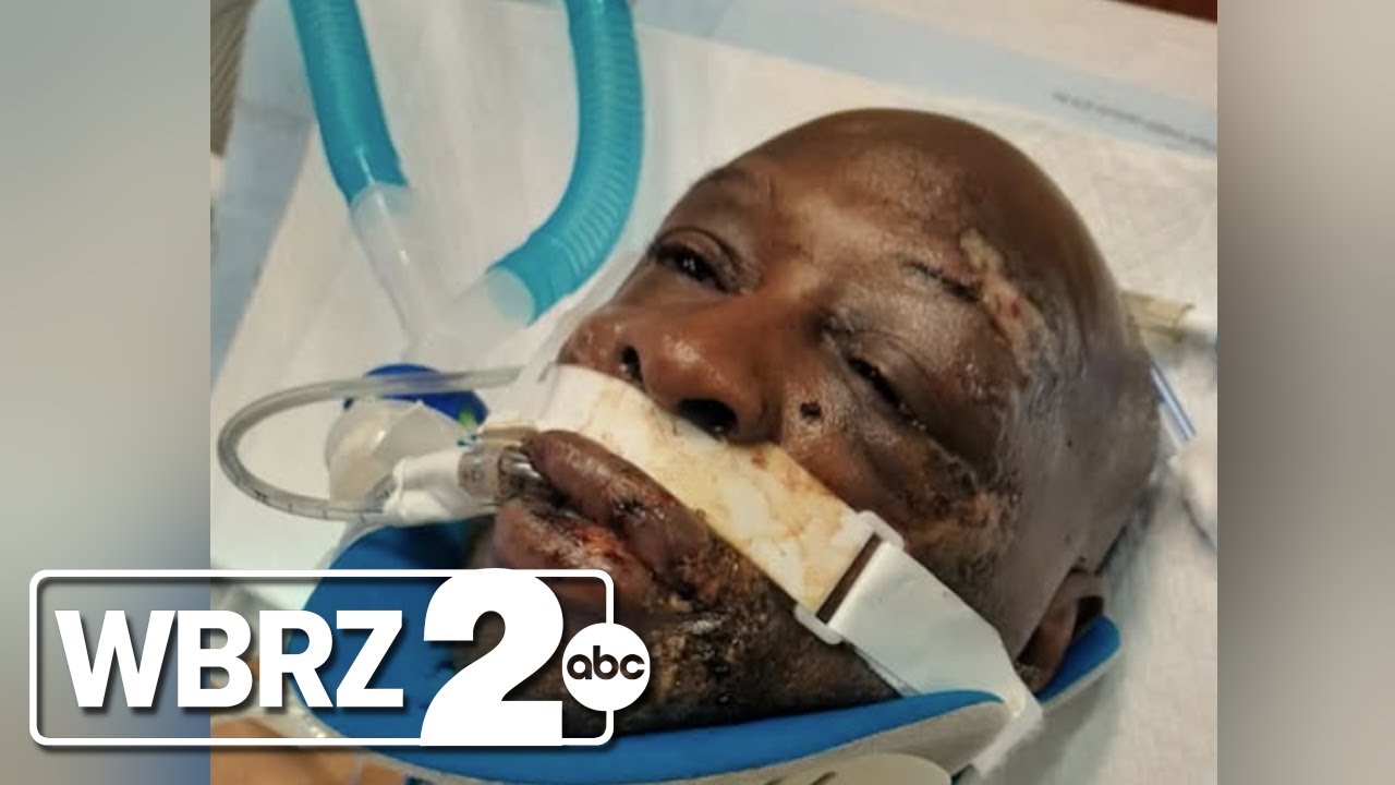 Hammond PD chief says alleged police brutality victim ran from officer during drug deal, was tased