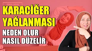 KARACİĞER EGZERSİZİ ( Karaciğer Yağlanması Neden olur , belirtileri ) Fizyoterapist Aynur BAŞ