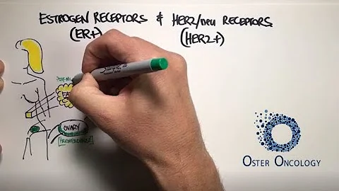 Estrogen Receptors &  HER2/neu Receptors in Breast...