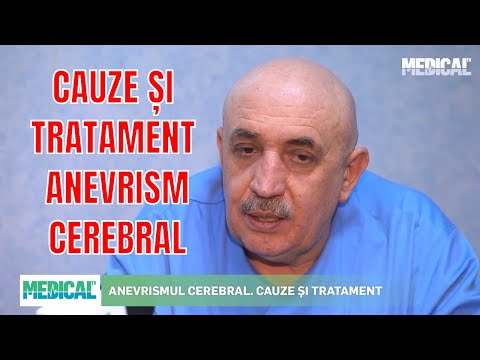 ANEVRISMUL CEREBRAL. CAUZE ȘI TRATAMENT