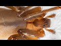 Spider heartbeat  brown recluse loxosceles reclusa