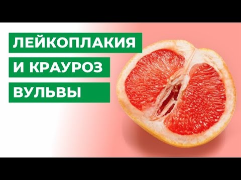 Лейкоплакия и крауроз вульвы. Что делать и как лечить?