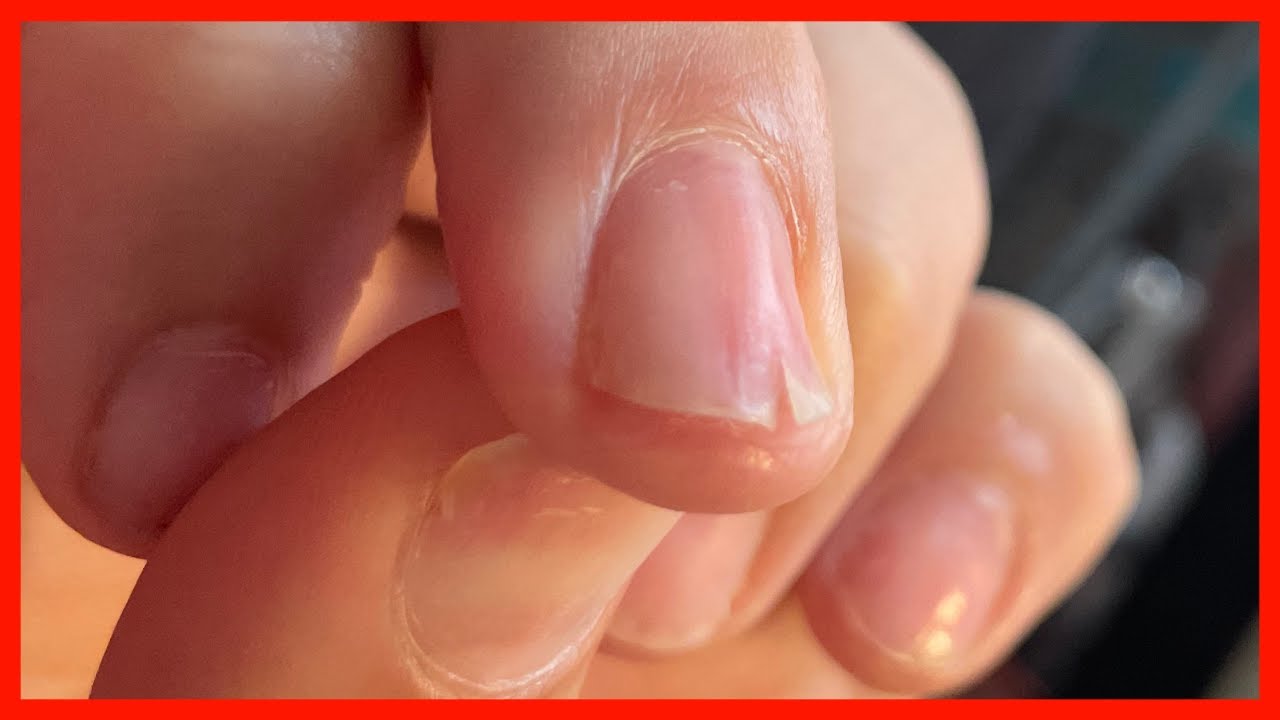 DANGER ⚠️ Over Filing the Natural Nail + How To FIX