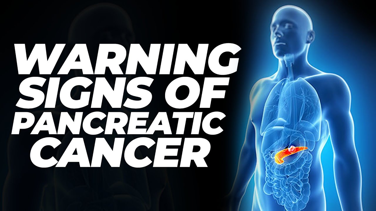 Pancreatic Cancer: Early Symptoms and Treatment Options - YouTube