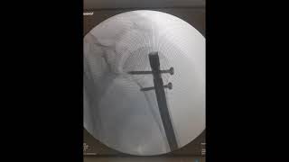 Marcelo Rios-15