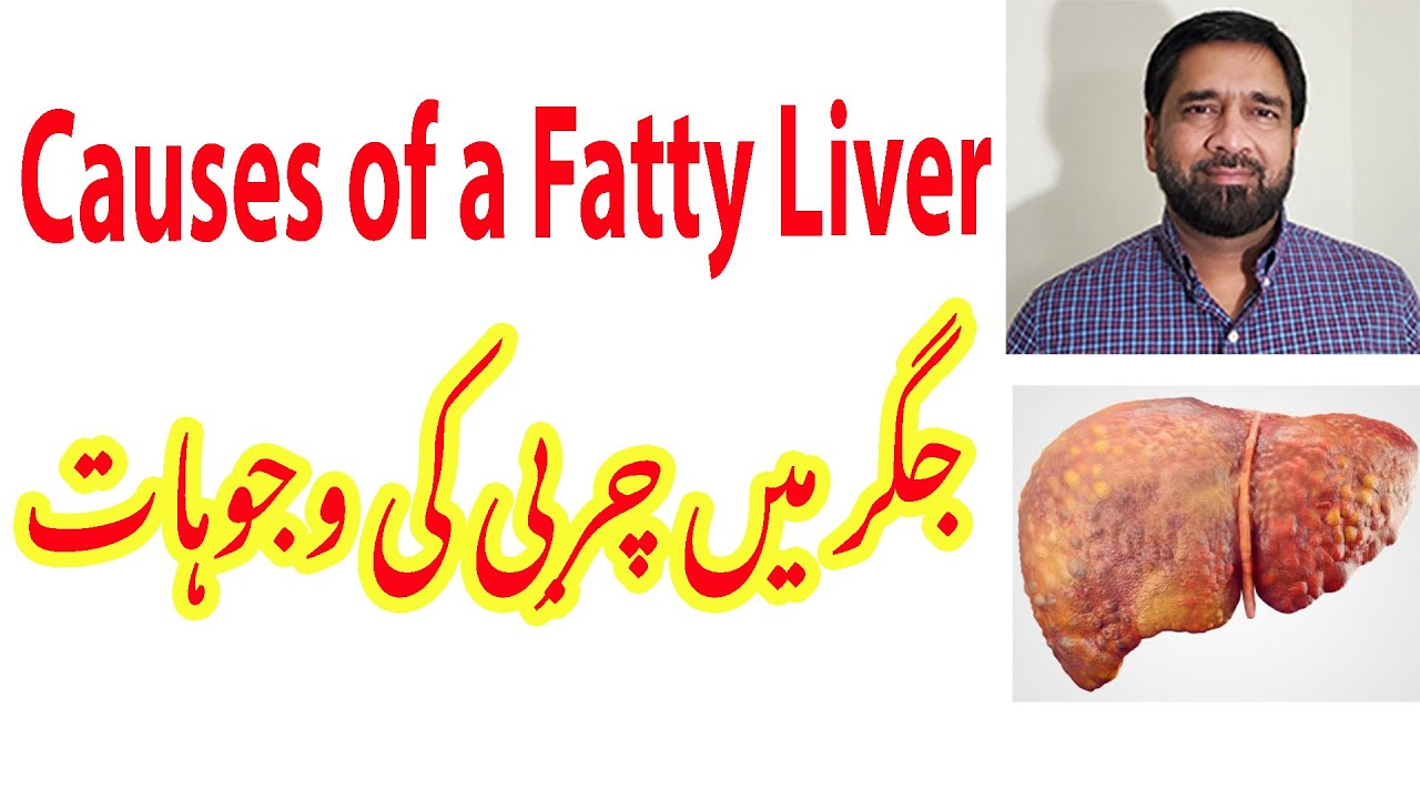Fatty Liver Causes of Fatty Liver Liver Fat Removal How to Remove