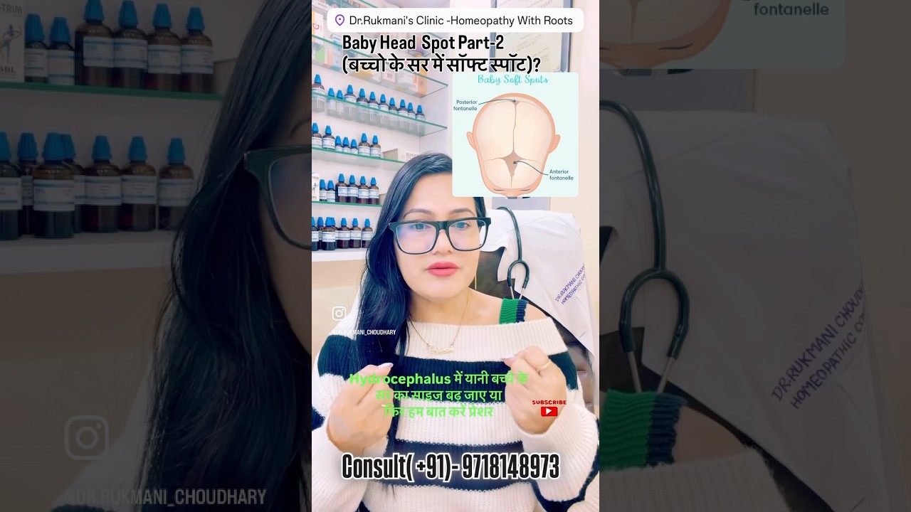 बच्चो के सिर में हड्डियों का देर से जुड़ना? Open Fontanelle |Baby Soft Spot ? 