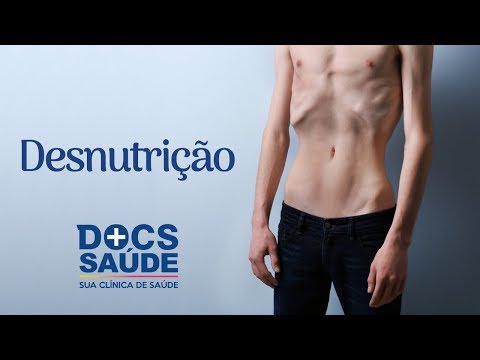 Vídeo: Deficiências Nutricionais (desnutrição): Sintomas E Tratamento