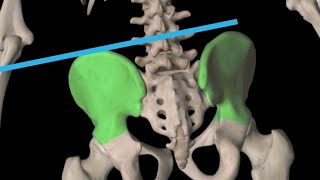 Correct a high hip.. تصحيح وتعديل الورك