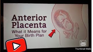 #playrightparent #pregnancy #anteriorplacenta i am not affiliated with
mama natural's channel, just wanted to use this public photo as an
educational piece. ...