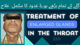 Treatment of all enlarged glands in the throat | with nafees clinic