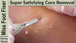 satisfy corns and callus by miss foot fixer marion yau