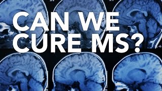 Can We Cure MS?