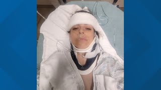 Atlanta stuntwoman, aerial performer shares hopeful message after skydiving accident