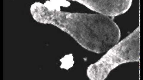 Animal cap elongation with Activin 01660