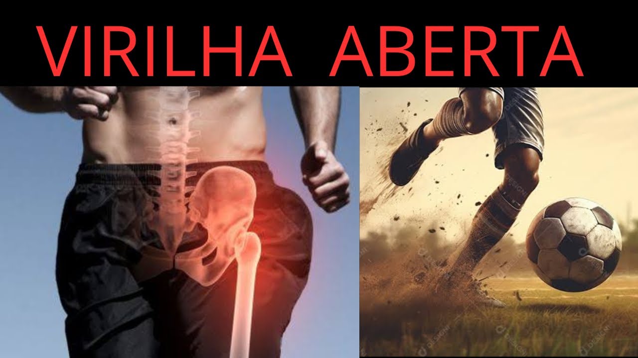 КАК ЛЕЧИТЬ ОТКРЫТУЮ РАНУ В ПАХЕ, ПОЛУЧЕННУЮ В ФУТБОЛУ #футбольныетравмы