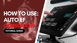 Mindray Consona N9 - Automatic Ef Measurement Demo