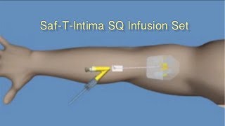 How to Insert Saf-T-Intima™ SQ Infusion Set