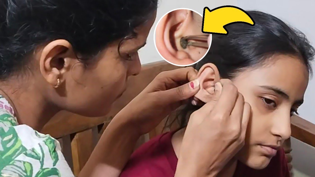 Ear Cleaning India | Satisfying Heavy Wax Removal ASMR