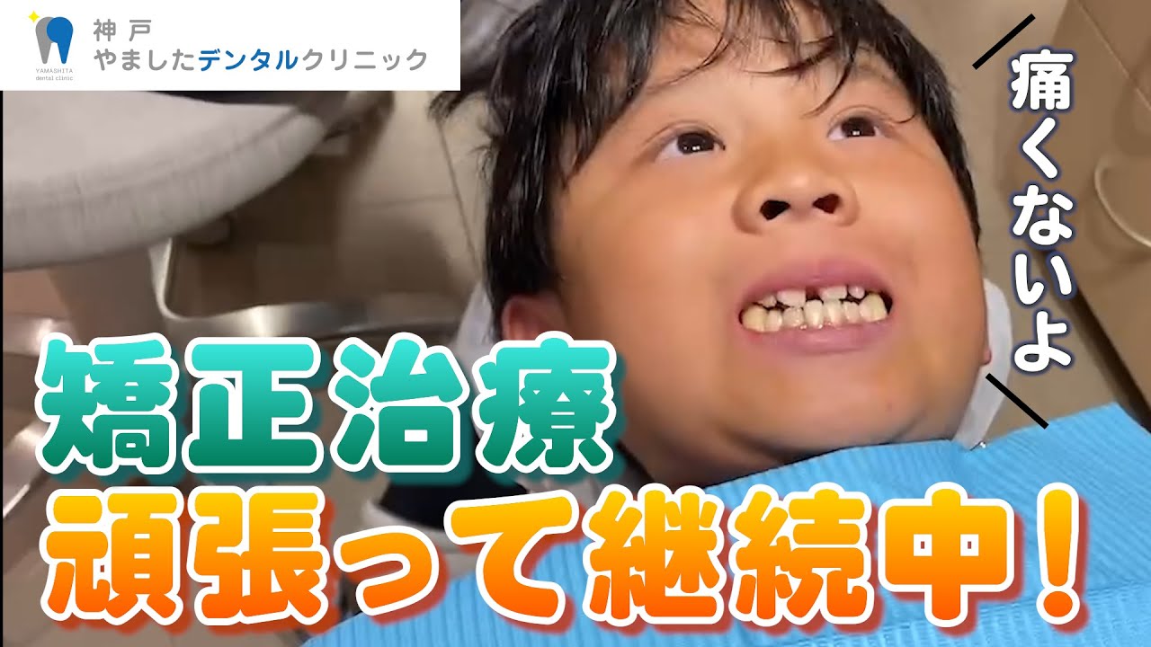 【矯正治療】頑張って継続中です！ - YouTube