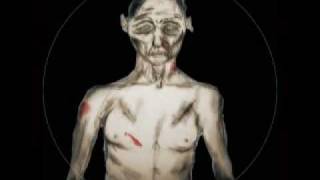 Skinflint - The Dead Speak - Audio