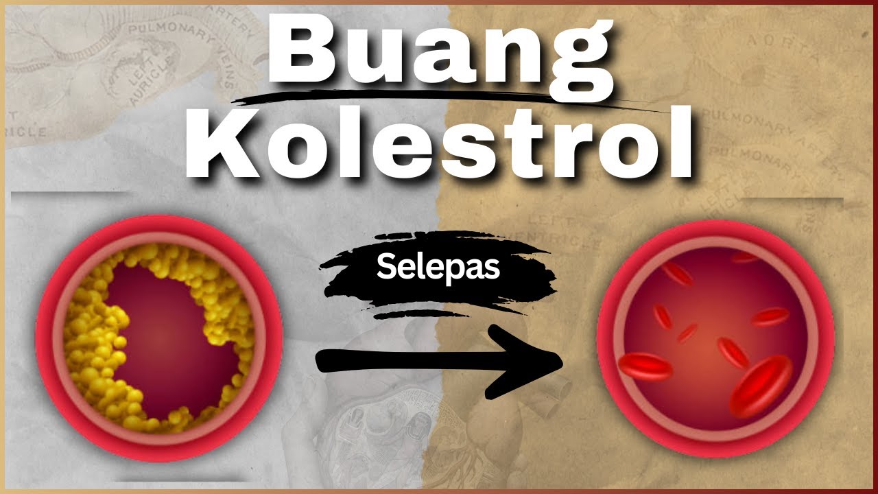 5 Cara Turunkan Kolestrol Jahat LDL Paling Berkesan | Doctor Sani |