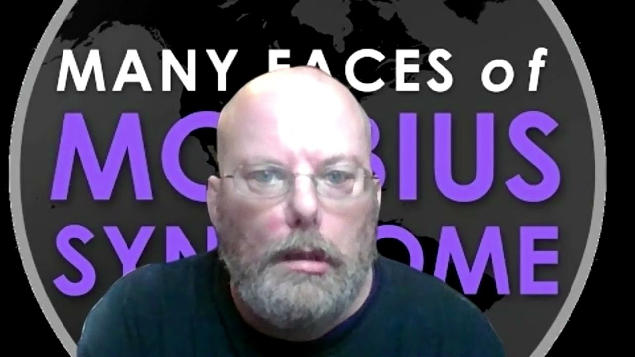 Tim Smith 2021 Many Faces of Moebius Syndrome Birthday Fundraiser.