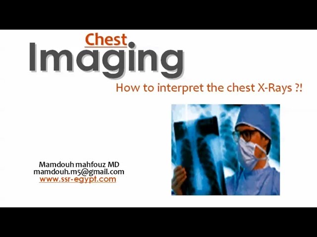 Chest X-ray interpretation (DRE) Prof. Mamdouh Mahfouz