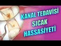 Kanal Tedavisi Sonrası Sıcak Ağrısı Olur mu?