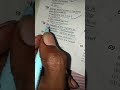 ABVMU Important Questions #shorts #bscnursing #biology #neet #aiims #newtrend #viral