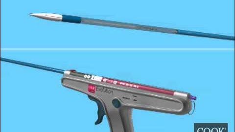 Evolution® Esophageal Controlled-Release Stent – Partially Covered / Fully Covered Handle Animation