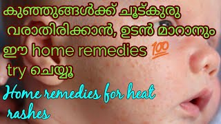 How Treat Heat Rash in kids|| Home remedies for  Heat Rash in infants