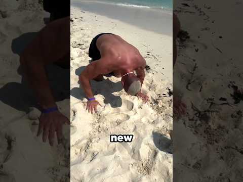 He Found A New Hairline 