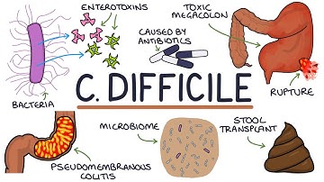 Understanding Clostridium Difficile Infection (C. Diff)