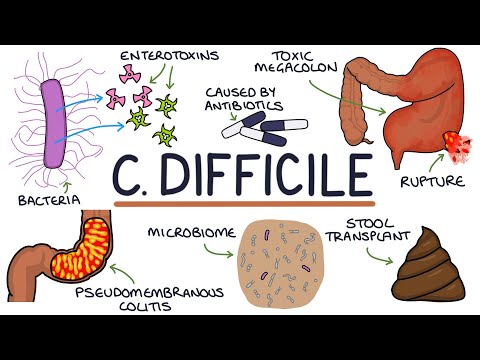 Understanding Clostridium Difficile Infection