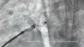 DRRAVIRT LARGE PDA DEVICE CLOSURE