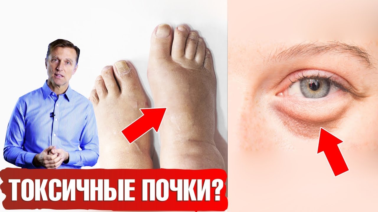 песок в моче что пить