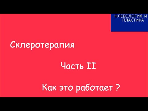 Склеротерапия вен Как работает? Пенная склеротерапия Сосудистые звездочки. Флеболог Алексей Суханов