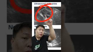 Kenapa program hamil diwajibkan USG? #shorts