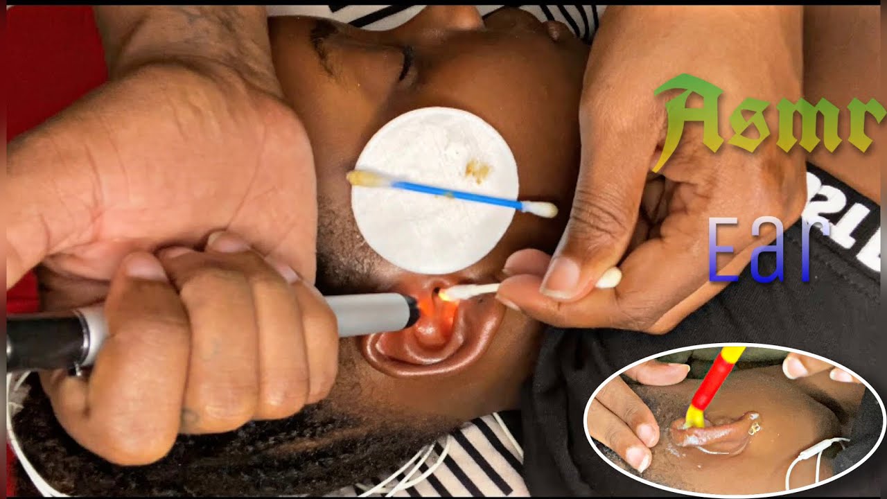Asmr Ear/ dirty ear cleaning/ massage/ wax removal ☺️✨