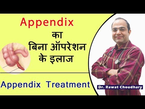 Best Treatment Of Appendix Without Operation | Appendicitis Best Treatment |