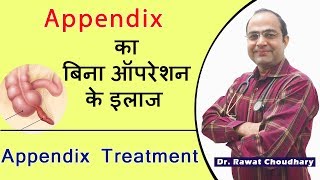 Best treatment of Appendix without operation | Appendicitis  Best Treatment | अपेंडिक्स का इलाज screenshot 2