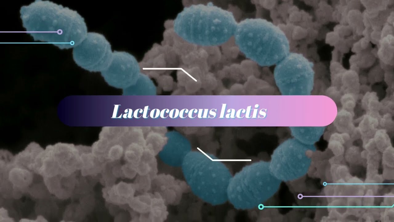 MicroVerse Project - Lactococcus lactis