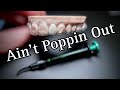 How to add a tooth to retainer by szara dental lab