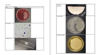 IDENTIFICATION OF UNKNOWN BACTERIA audio
