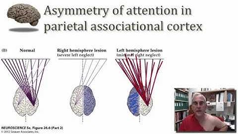 Associational Cortex of the Parietal Lobe part 2