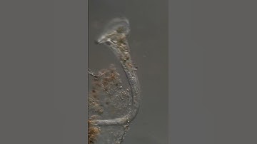 microscopy video -stentor