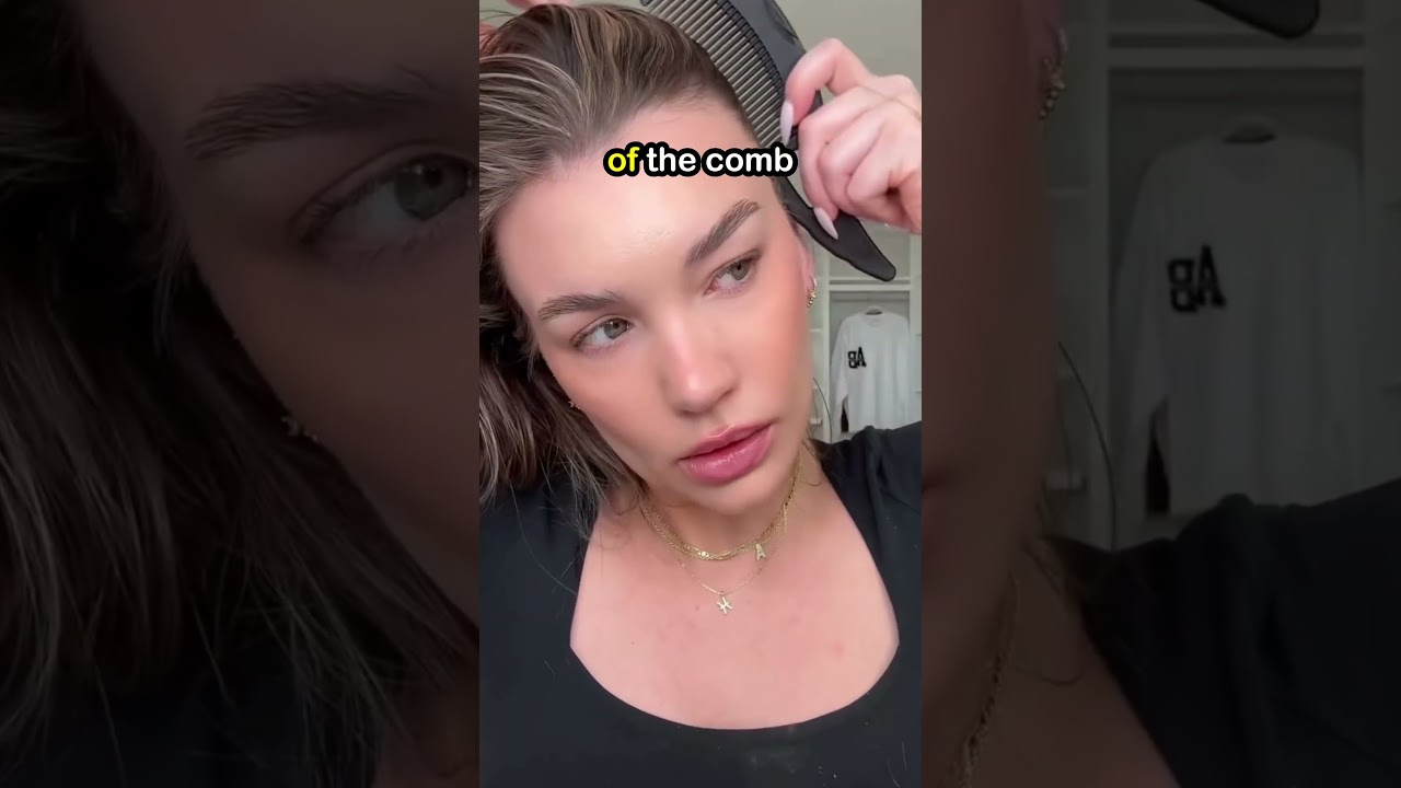 How to find your dandruff type 😲