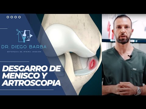 Video: ¿Duele el desgarro de menisco?