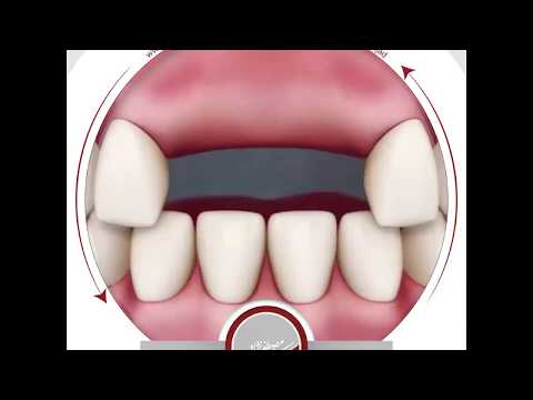 انیمیشن تحلیل استخوان دکتر اشکان مصطفی نژاد